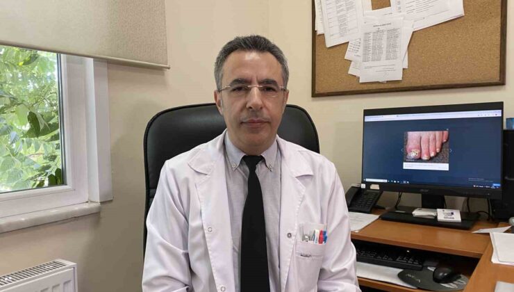 Uzmanlar uyarıyor: “Mantar enfeksiyonlarında artış görüyoruz, tedaviye direnç söz konusu”