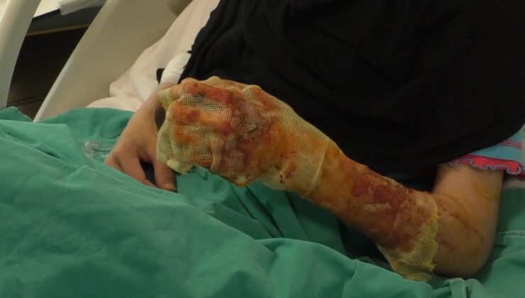 Mangal ateşine dezenfektan döken çift dehşeti yaşadı: “Eşim ateşi harlamak istedi, lütfen acele etmeyin”