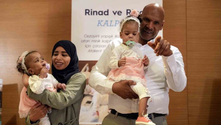 Cezayirli yapışık ikizler Türkiye’de yapılan operasyonla ayrıldı